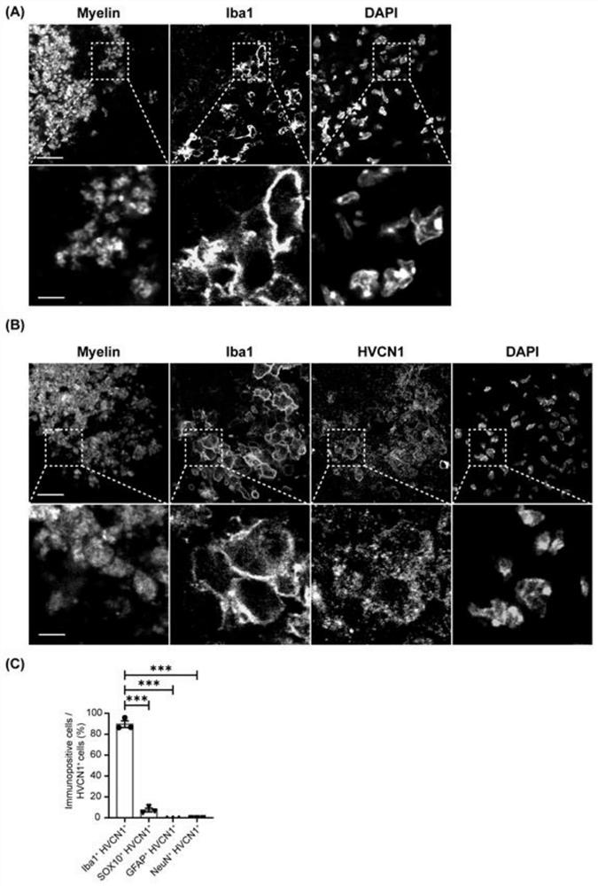Application of HVCN1 antibody in preparation of medicine for treating nerve injury or neurodegenerative diseases