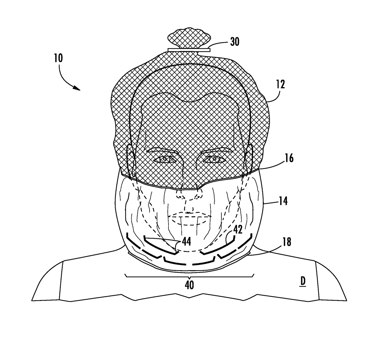 Transport hood having perforations