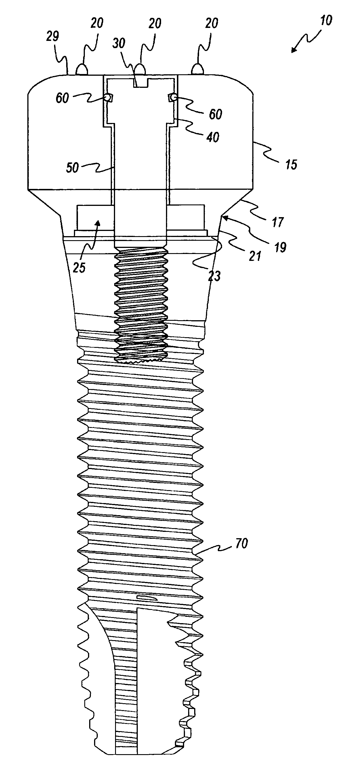 Healing components for use in taking impressions and methods for making the same