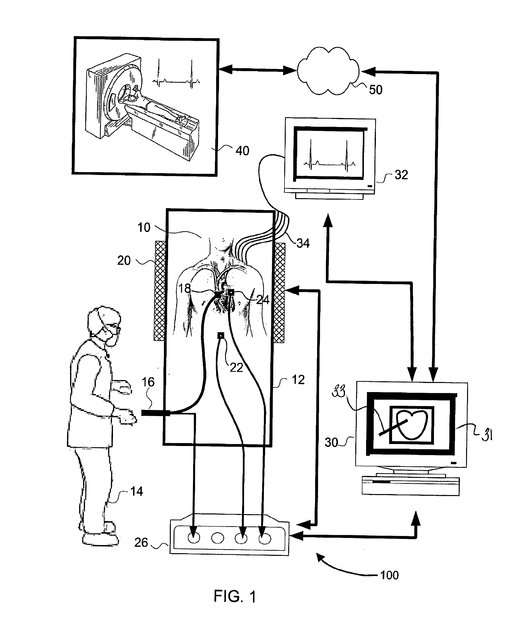 Bodily sealants and methods and apparatus for image-guided delivery of same