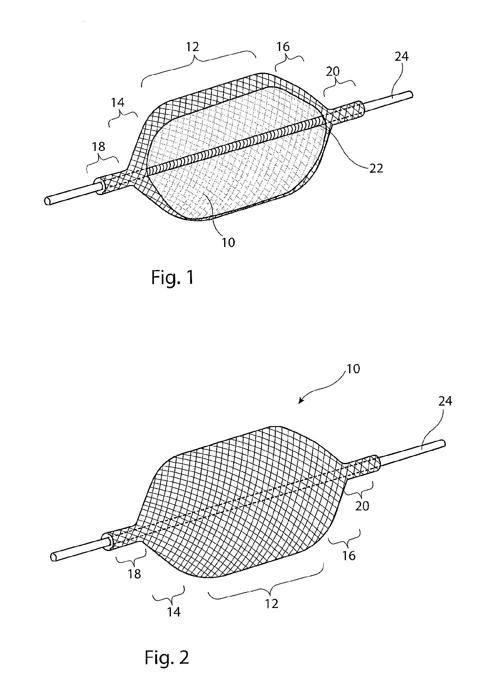 Vascular occlusion device