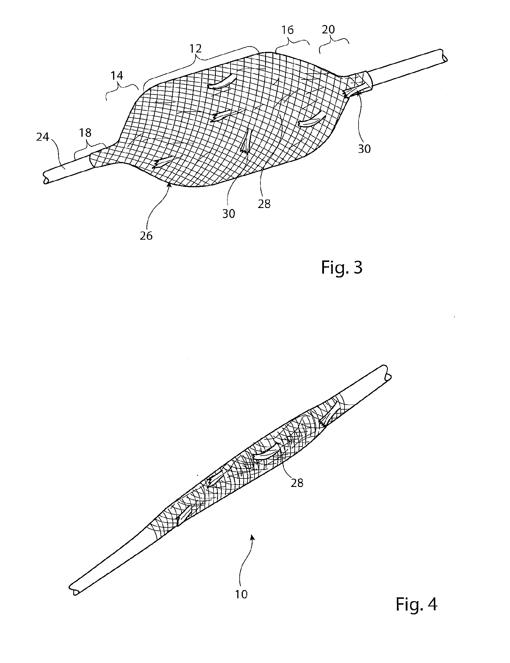 Vascular occlusion device