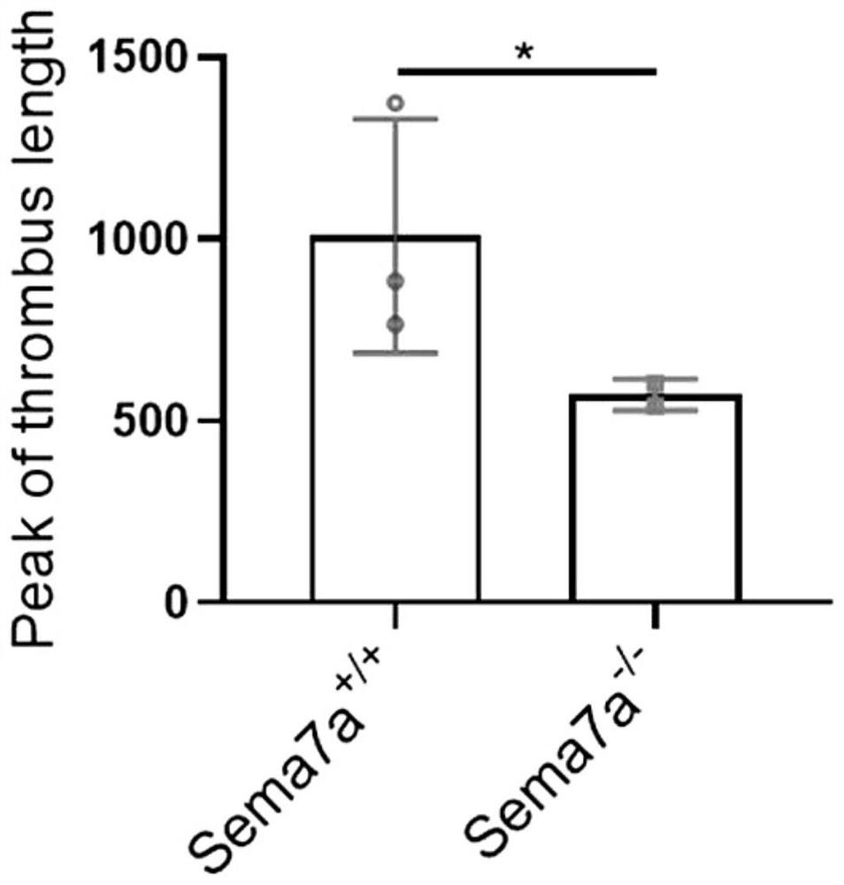 Application of Semaphorin7A monoclonal antibody in preparation of medicine for treating thrombus and cerebrovascular diseases