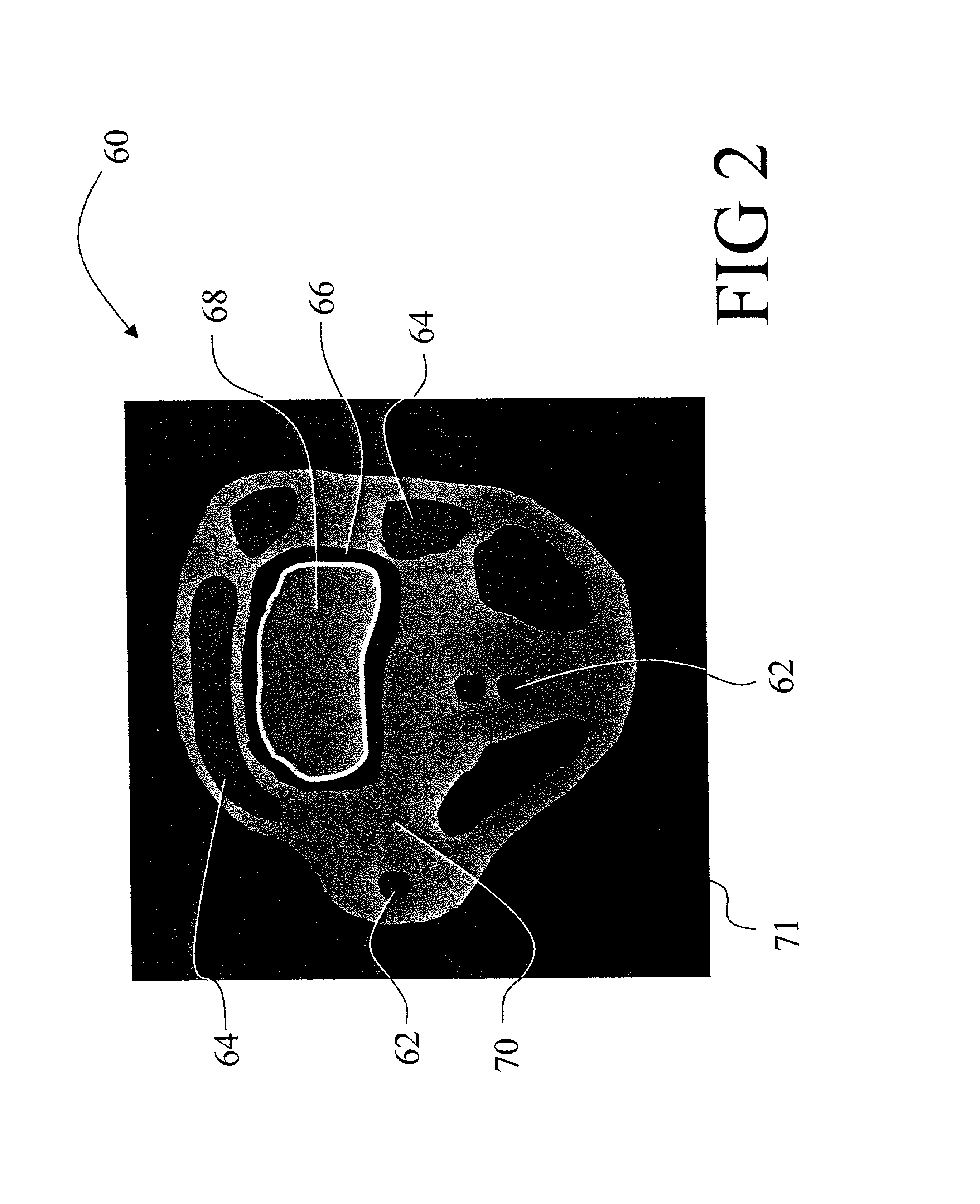 Black blood angiography method and apparatus