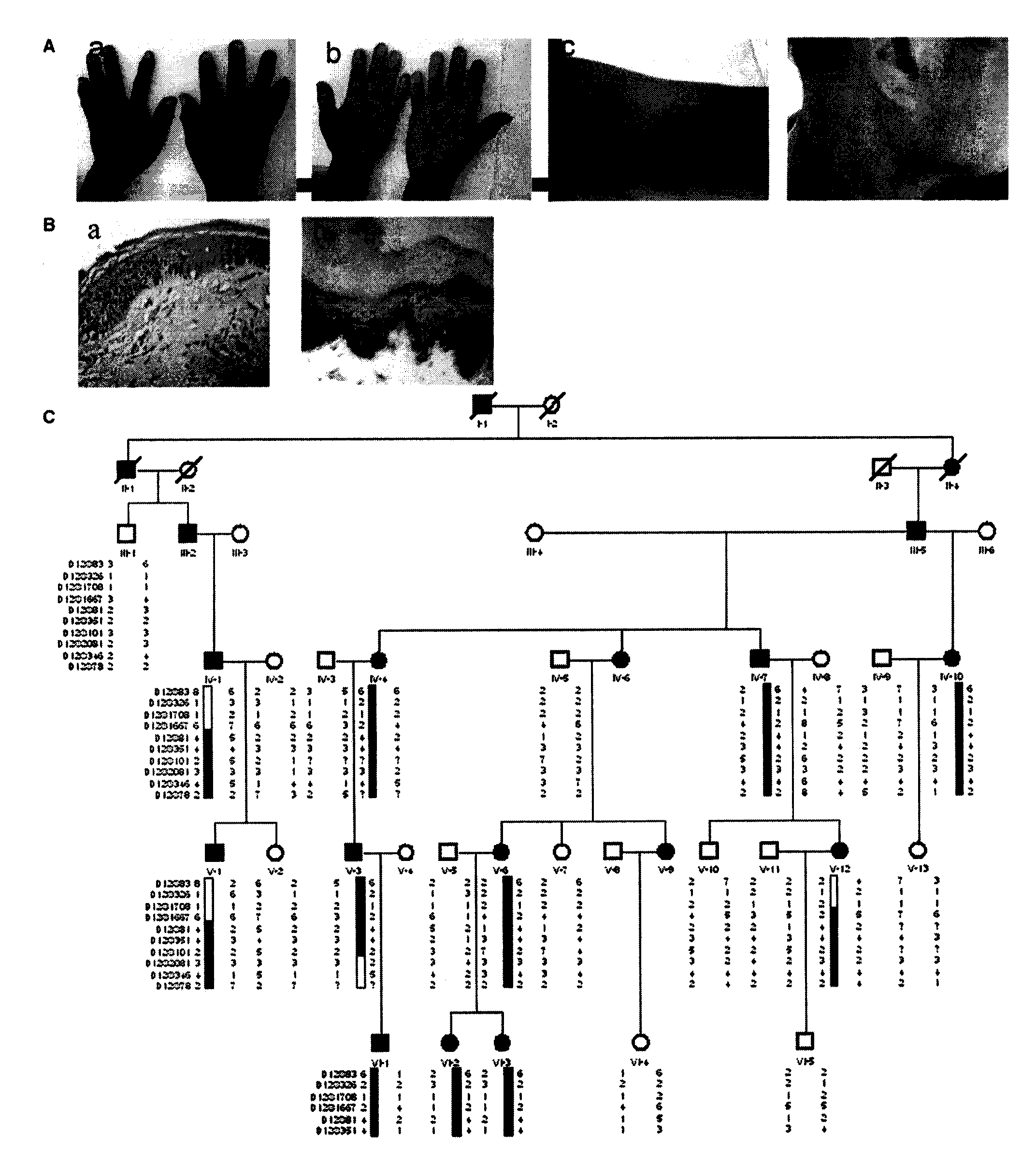 Pigment synthesis KIT ligand and application thereof