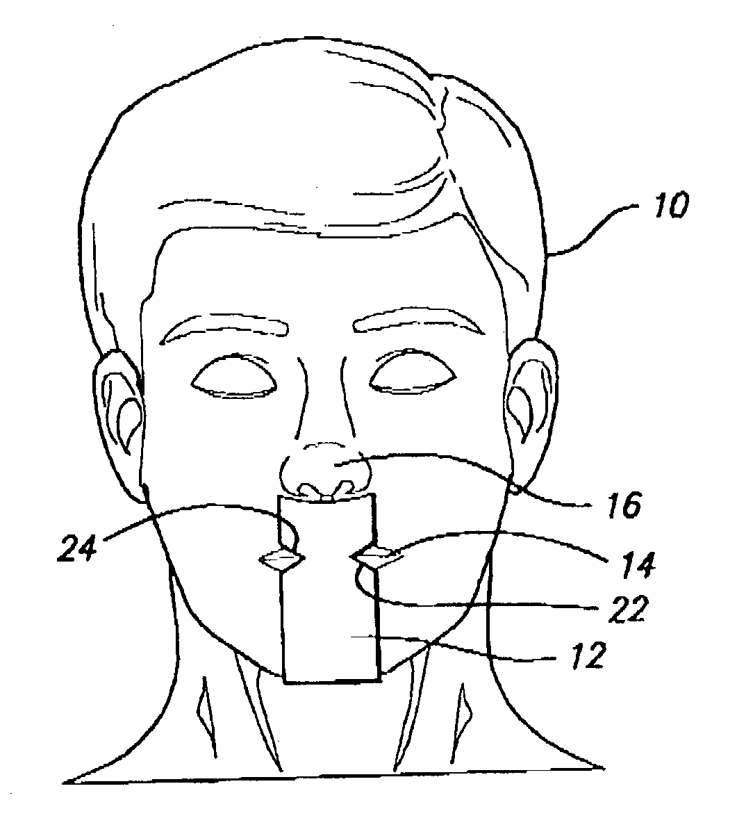 Snoreway space block with snore strips or portnoy buccal tab