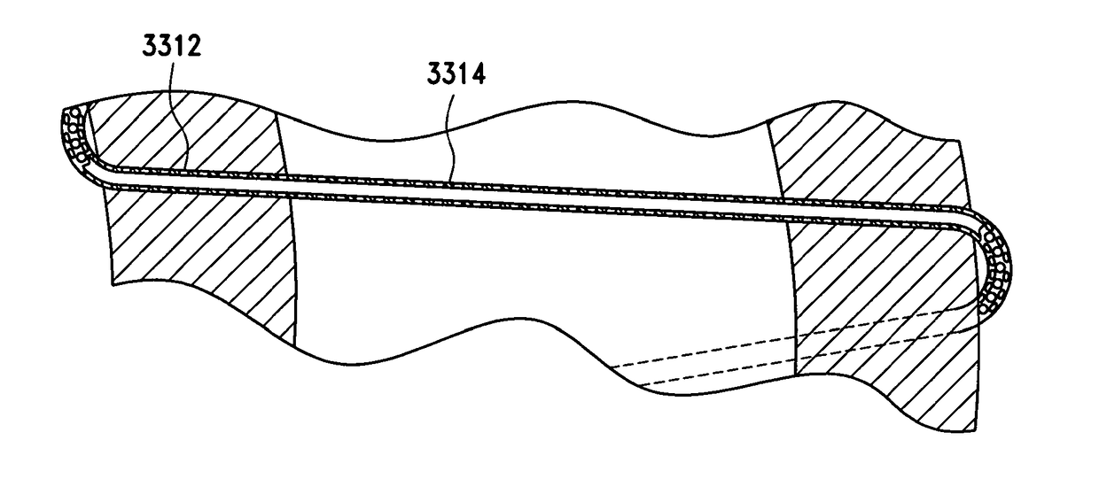 Method for suture lacing