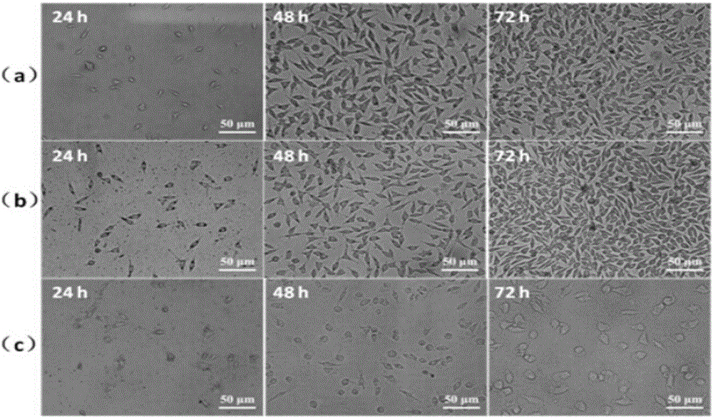 Eye implantation type ketorolac tromethamine-carrying sustained release preparation and preparation method thereof