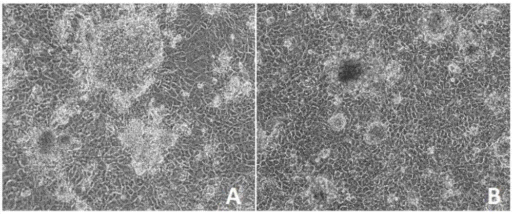 A wound-adhesive artificial active tissue constructed with serum-free and bovine pituitary extract culture fluid and its construction method