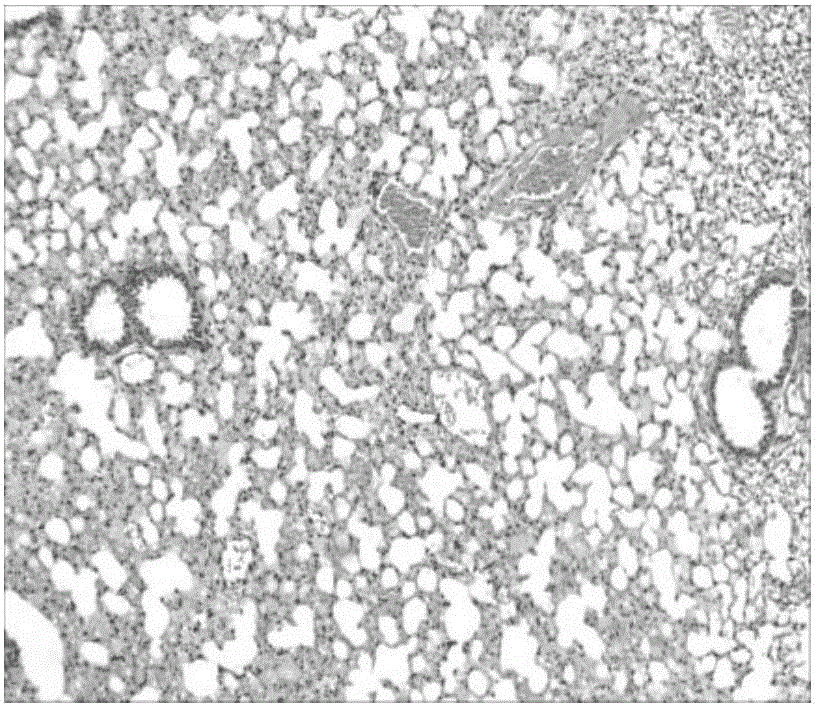 Application of cinnamaldehyde in preparation of drugs for targeted therapy of bacterial infection