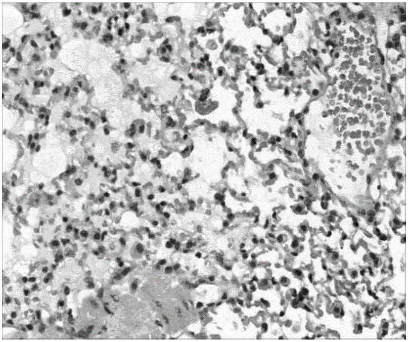 Application of cinnamaldehyde in preparation of drugs for targeted therapy of bacterial infection