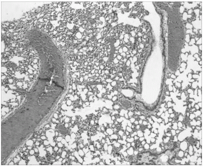 Application of cinnamaldehyde in preparation of drugs for targeted therapy of bacterial infection