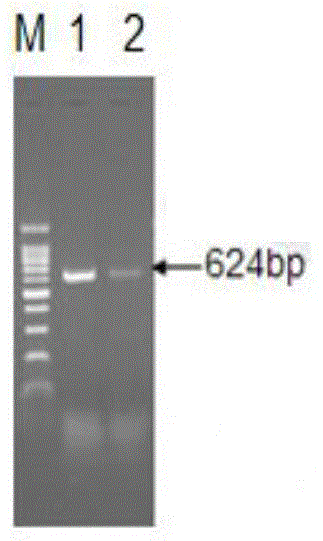Lentiviral vector of fusion green fluorescent protein with over expression of RAB7A and EGFP genes, building method and application thereof