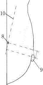 Calcification location method based on dual-view mammography