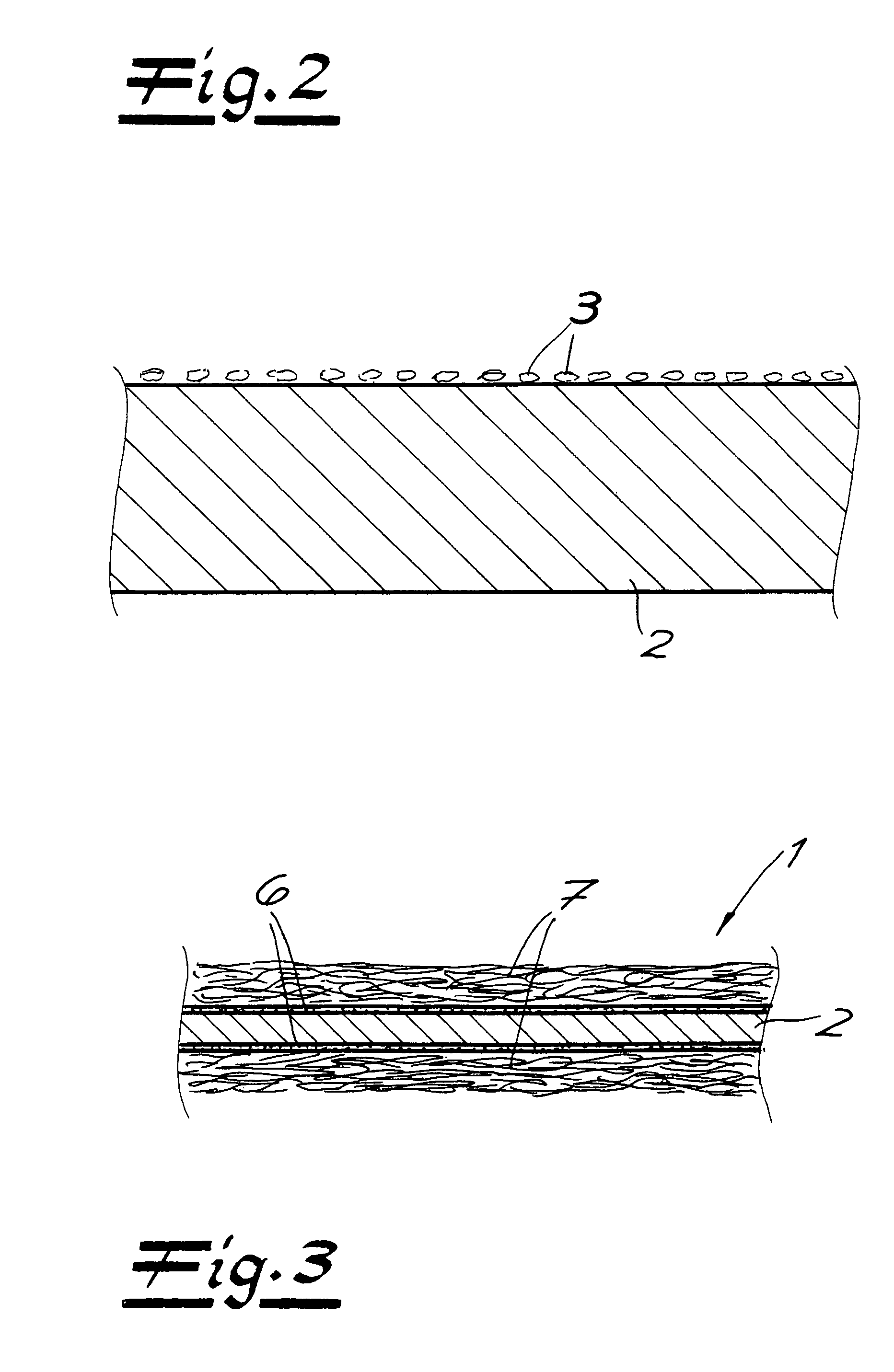 Method for the production of an elastic laminate material web