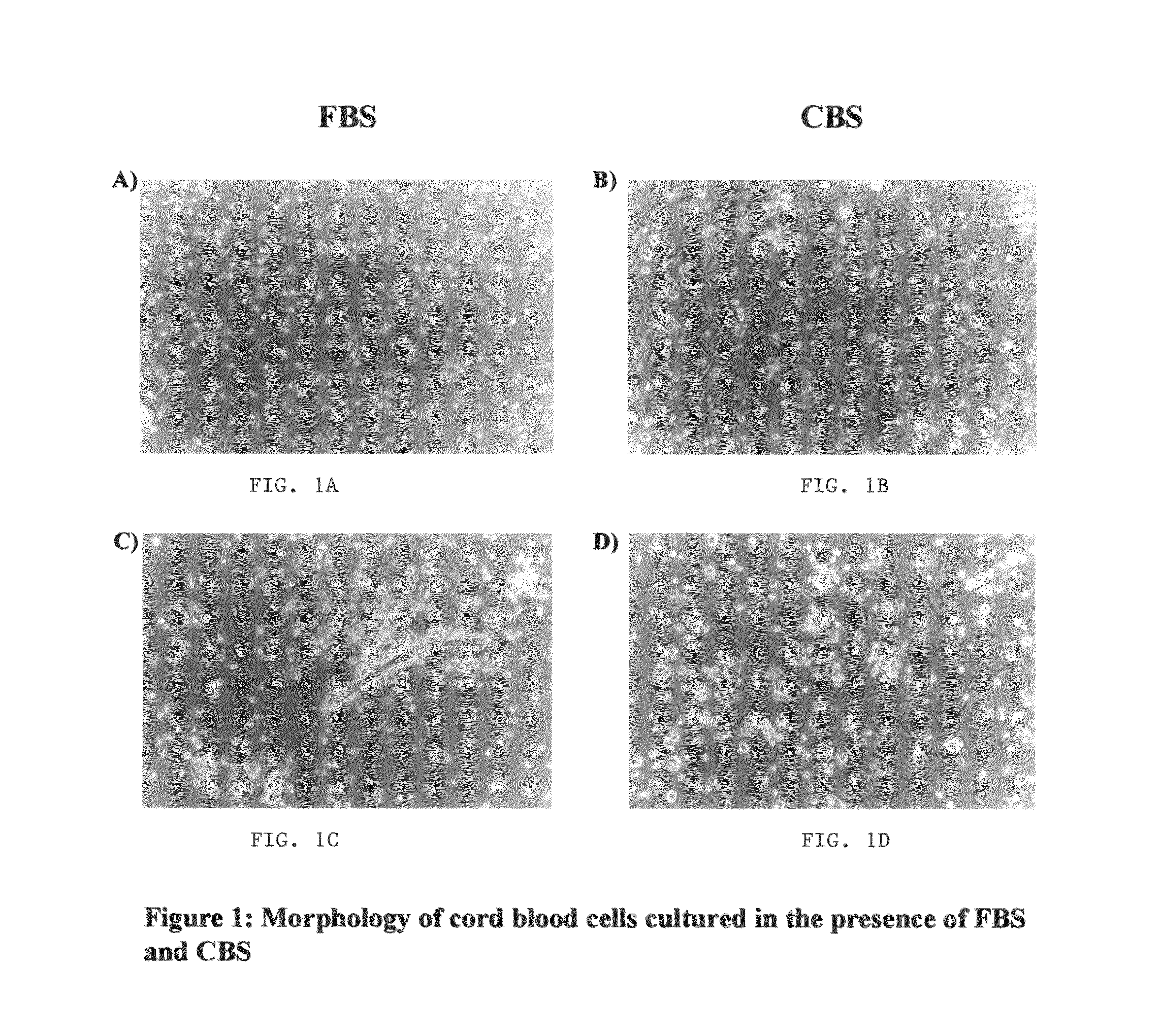 Growth of neural precursor cells using umbilical cord blood serum and a process for the preparation for therapeutic purposes