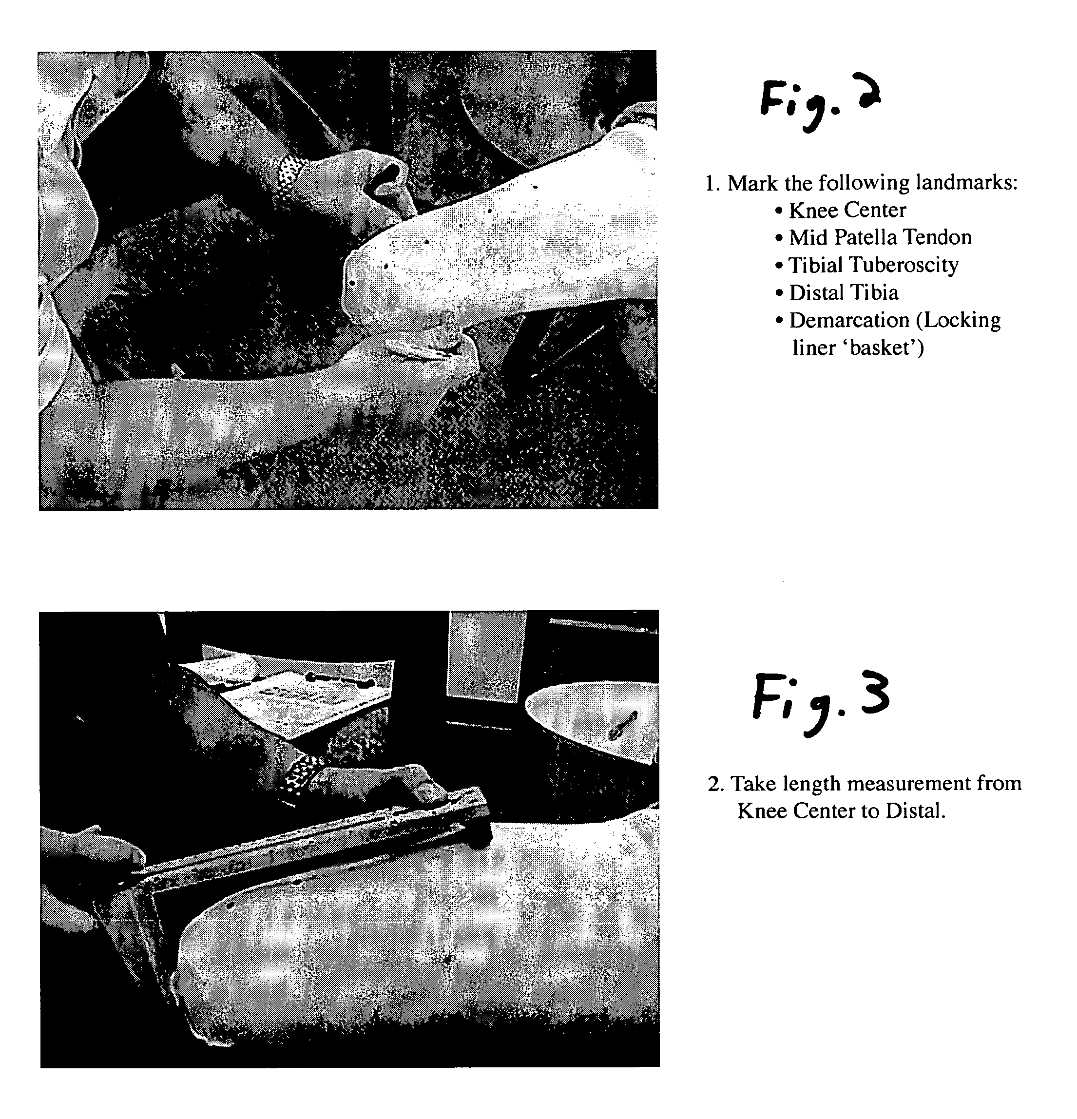 Method and associated system for recording and retrieving fabrication and/or fitting data associated with a prosthetic component