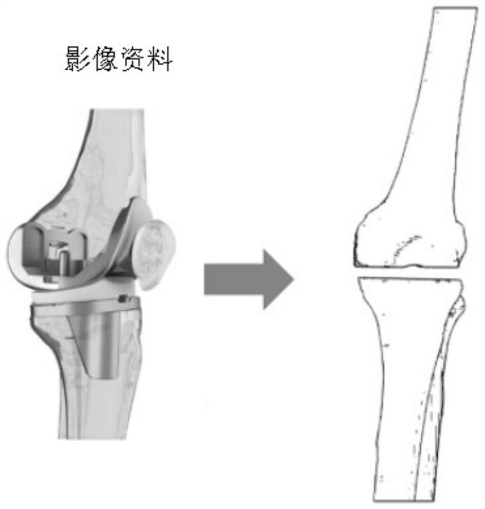 A kind of knee spacer and preparation method thereof