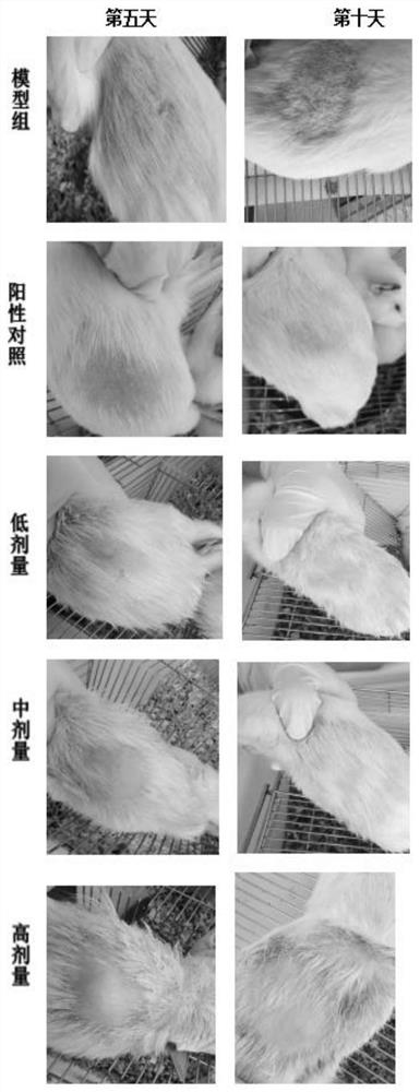 Traditional Chinese medicine leavening and application thereof in preparation of medicine for treating dermatosis caused by fungal infection