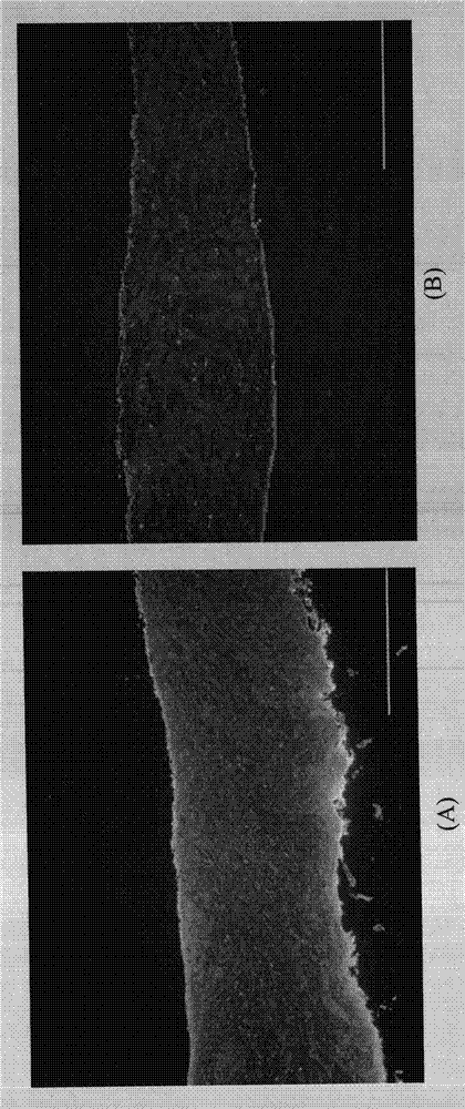 Specimen pretreatment method for reducing auto-fluorescence interference in FISH (fluorescence in situ hybridization) and reagent kit therefor