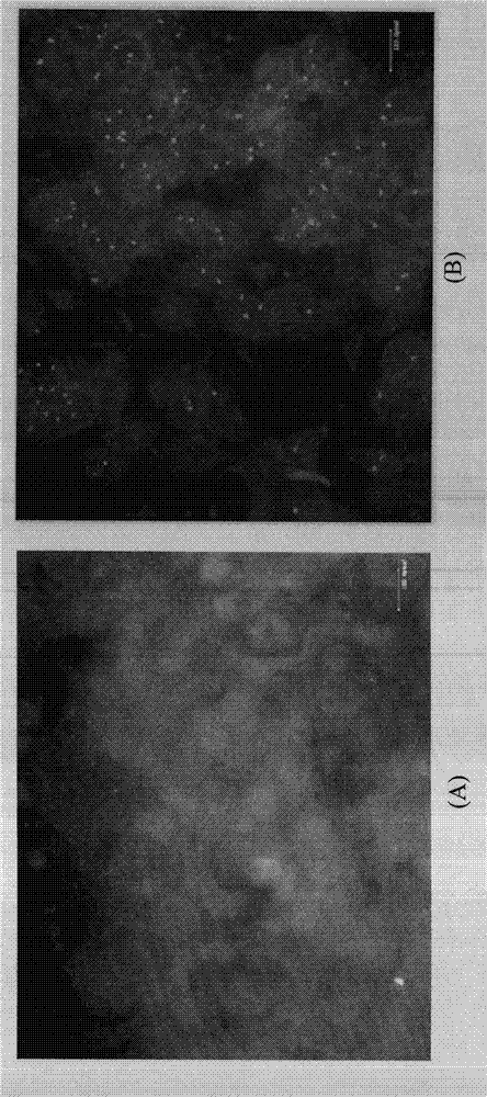 Specimen pretreatment method for reducing auto-fluorescence interference in FISH (fluorescence in situ hybridization) and reagent kit therefor