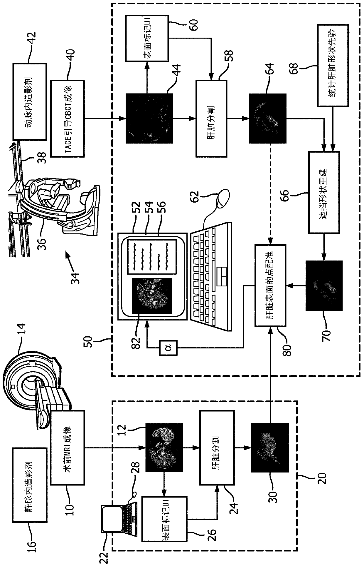 Cbct to mr registration via occluded shape reconstruction and robust point matching