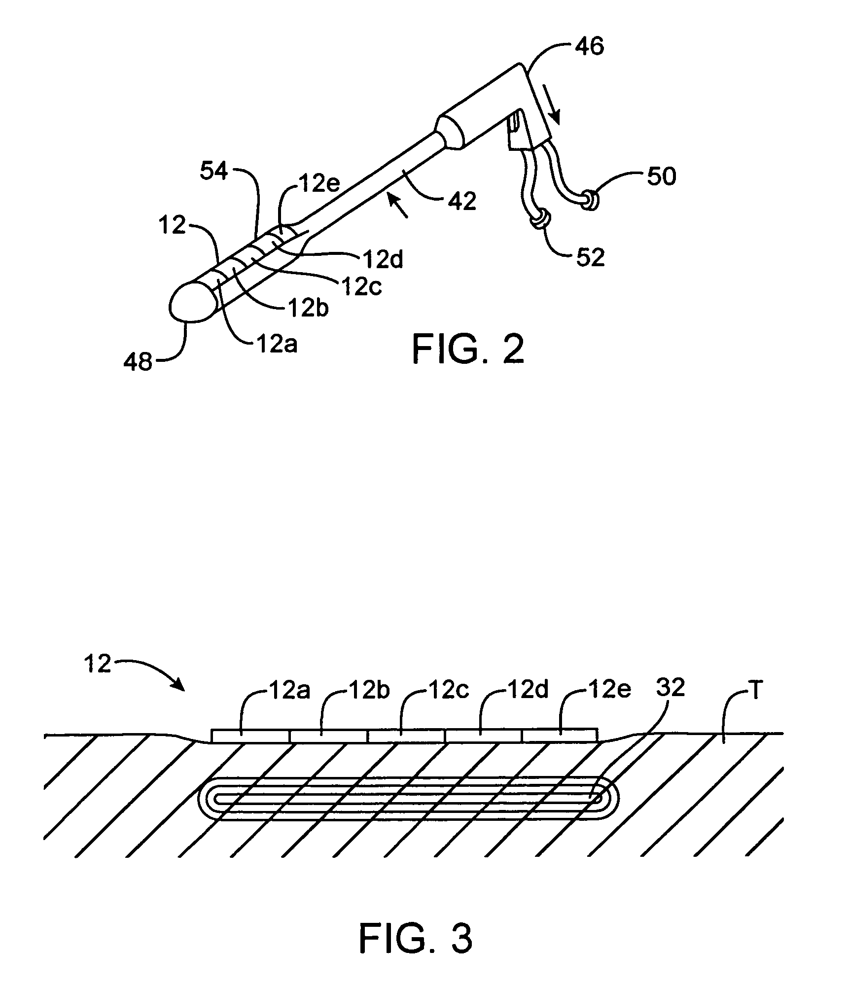 Heating method for tissue contraction