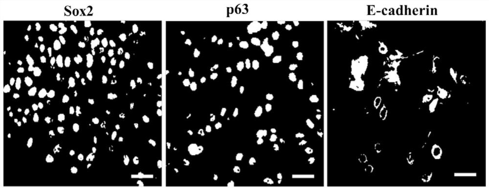Method for efficiently inducing advanced branched pulmonary organs in vitro, experimental model and compound combination