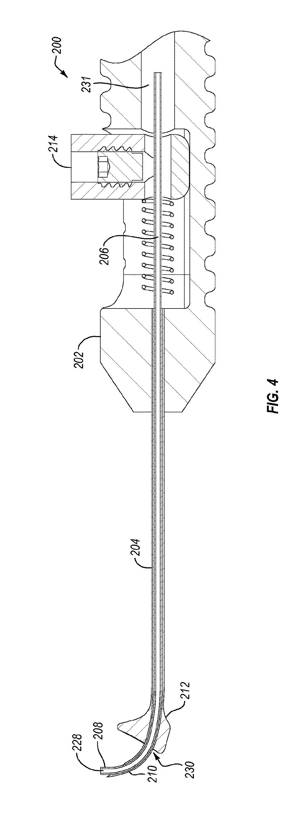 Cannula for external drainage of subretinal fluid