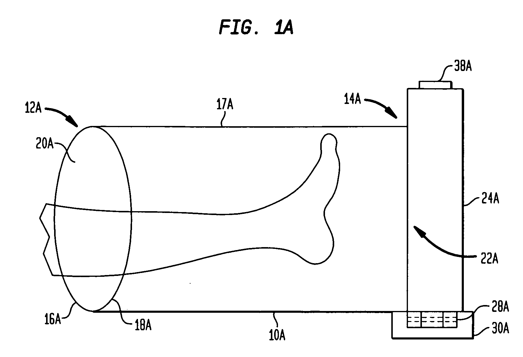 Wound treatment device
