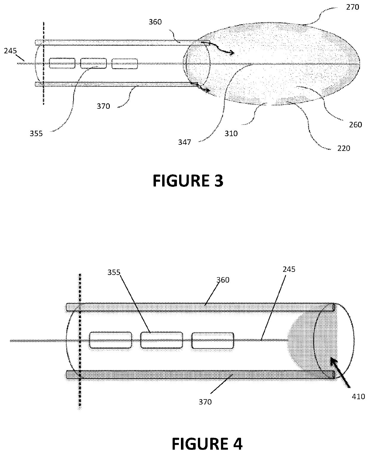 Method and apparatus for coaptive ultrasound gastrostomy