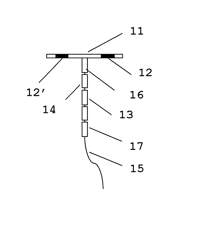 Copper-releasing hybrid iud with adaptable retention arm connected to frameless body
