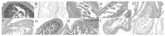 Construction of long-circulating liposome of fraxetin and its research on anti-enteritis effect