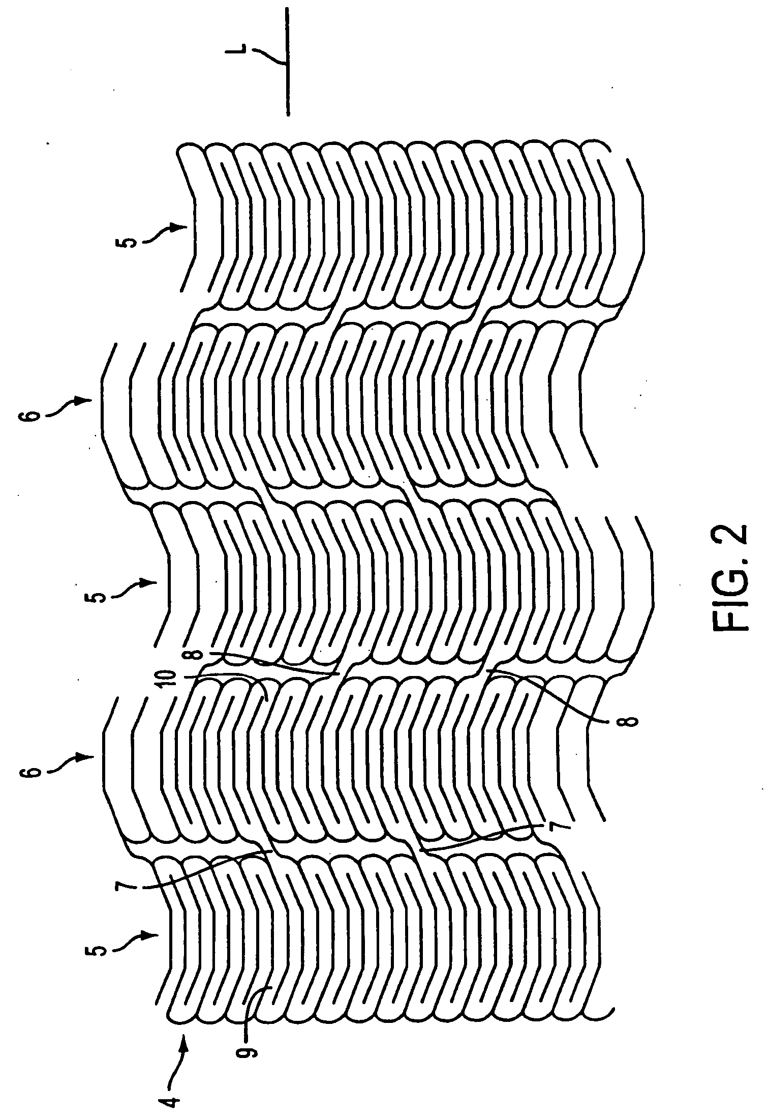Methods and apparatus for a stent having an expandable web structure and delivery system
