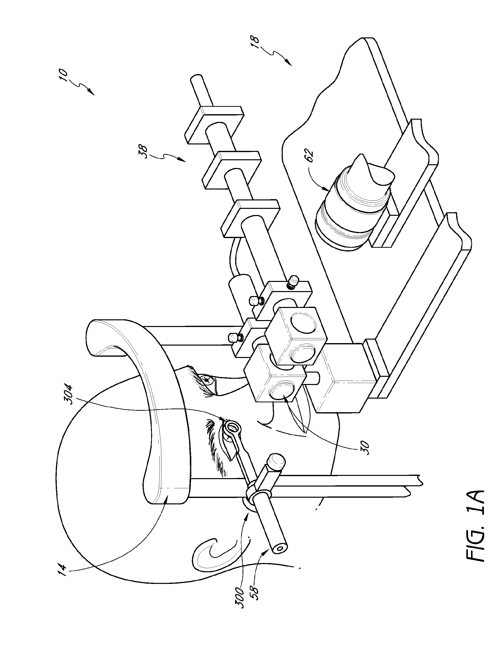 Method and apparatus for centration of an ocular implant