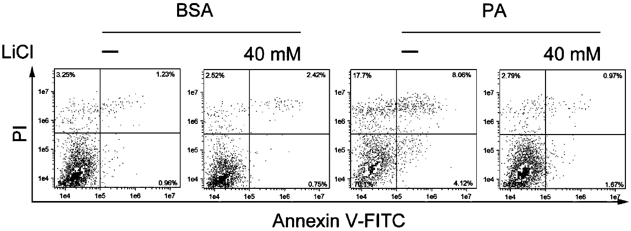 Application of LiCl in preparation of drug for resisting myocardial apoptosis induced by excessive accumulation of lipids