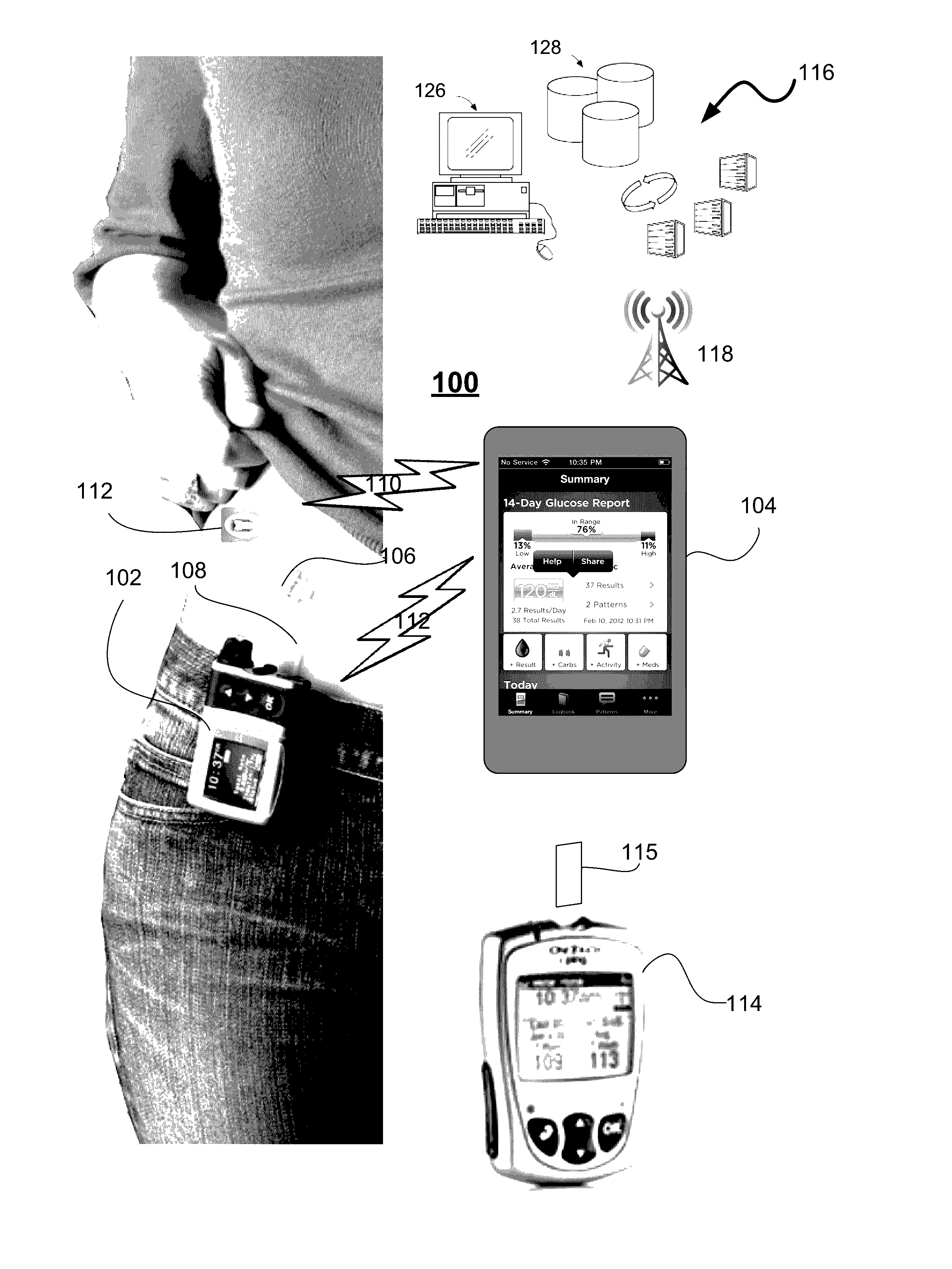 Method and system for tuning a closed-loop controller for an artificial pancreas
