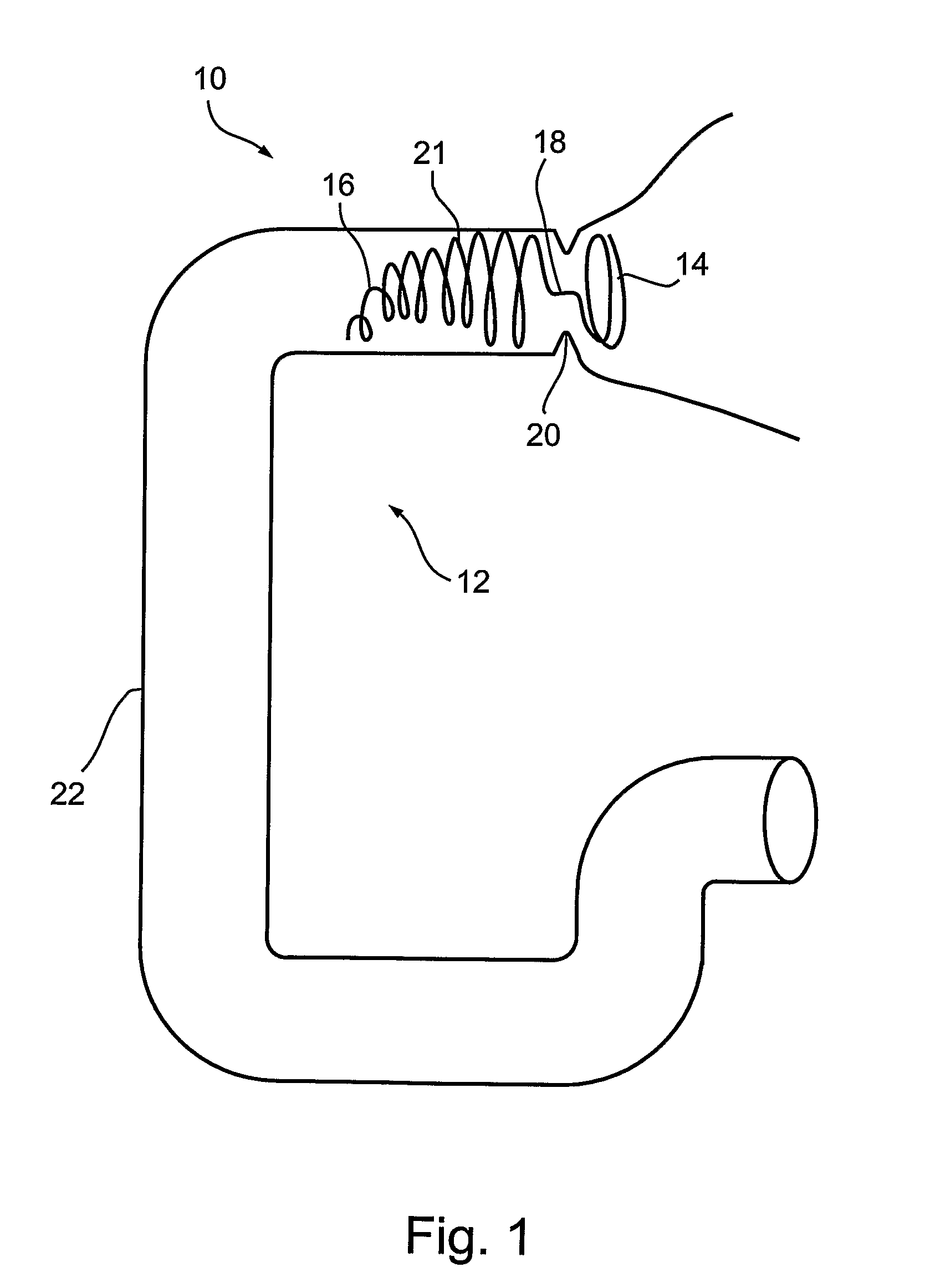 Duodenal stimulation devices and methods for the treatment of conditions relating to eating disorders