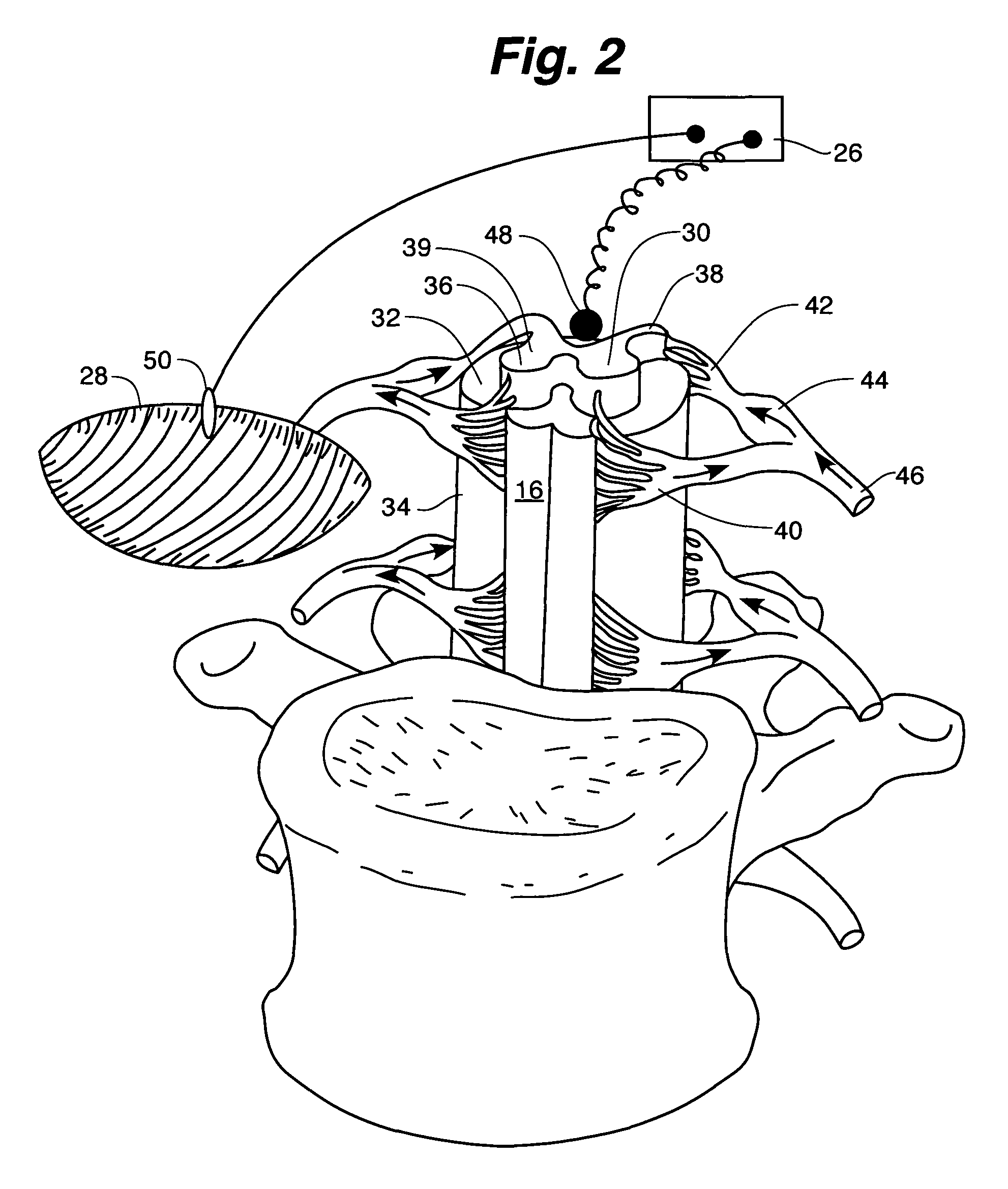 Method and apparatus for improving renal function