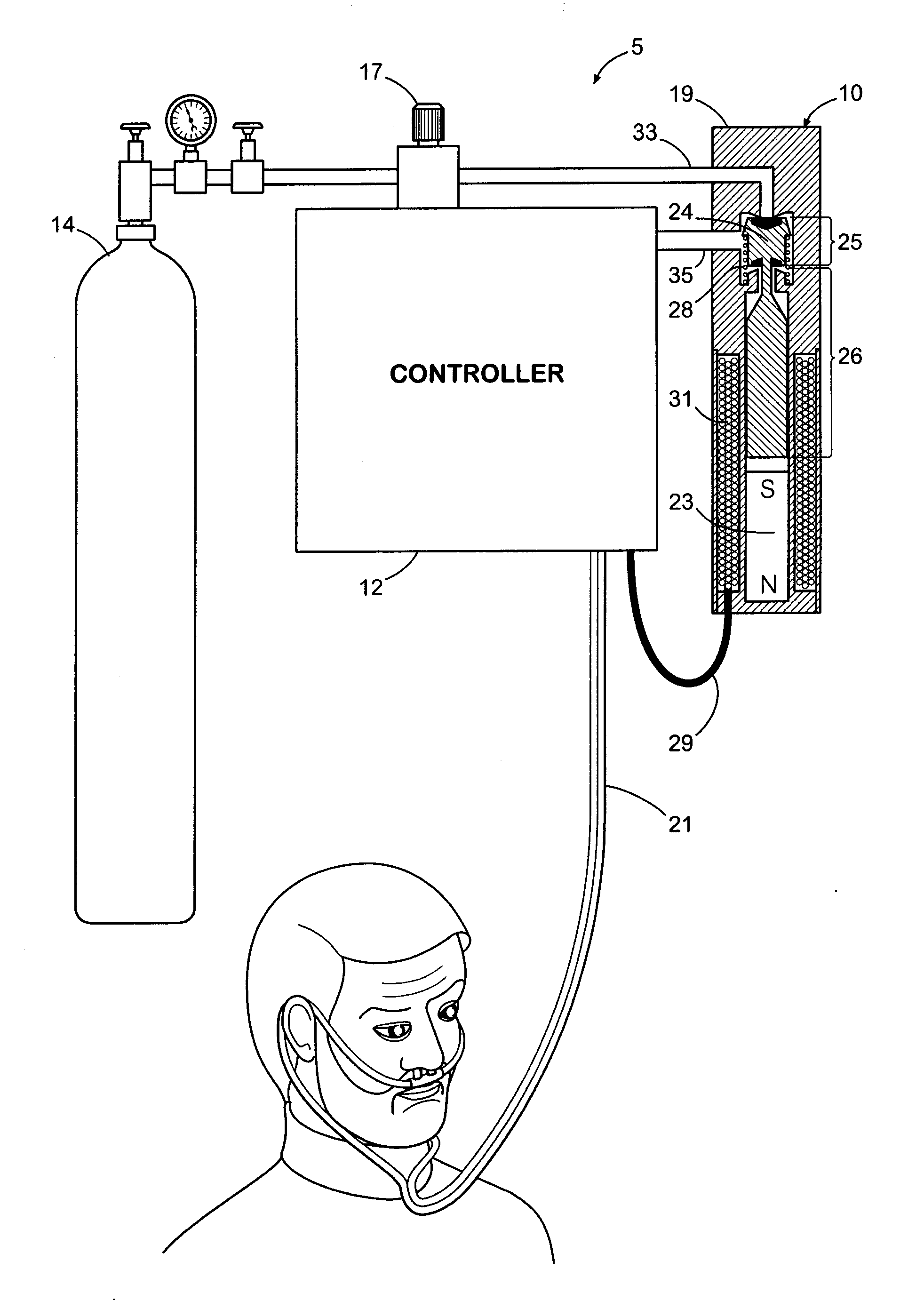 Gas Conserving Device