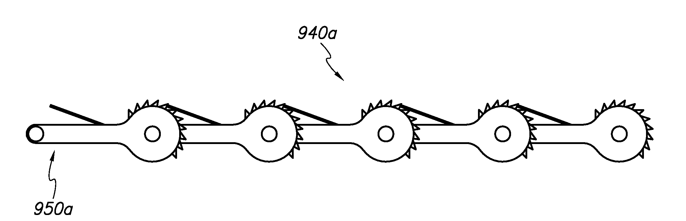 Devices and methods for push-delivery of implants