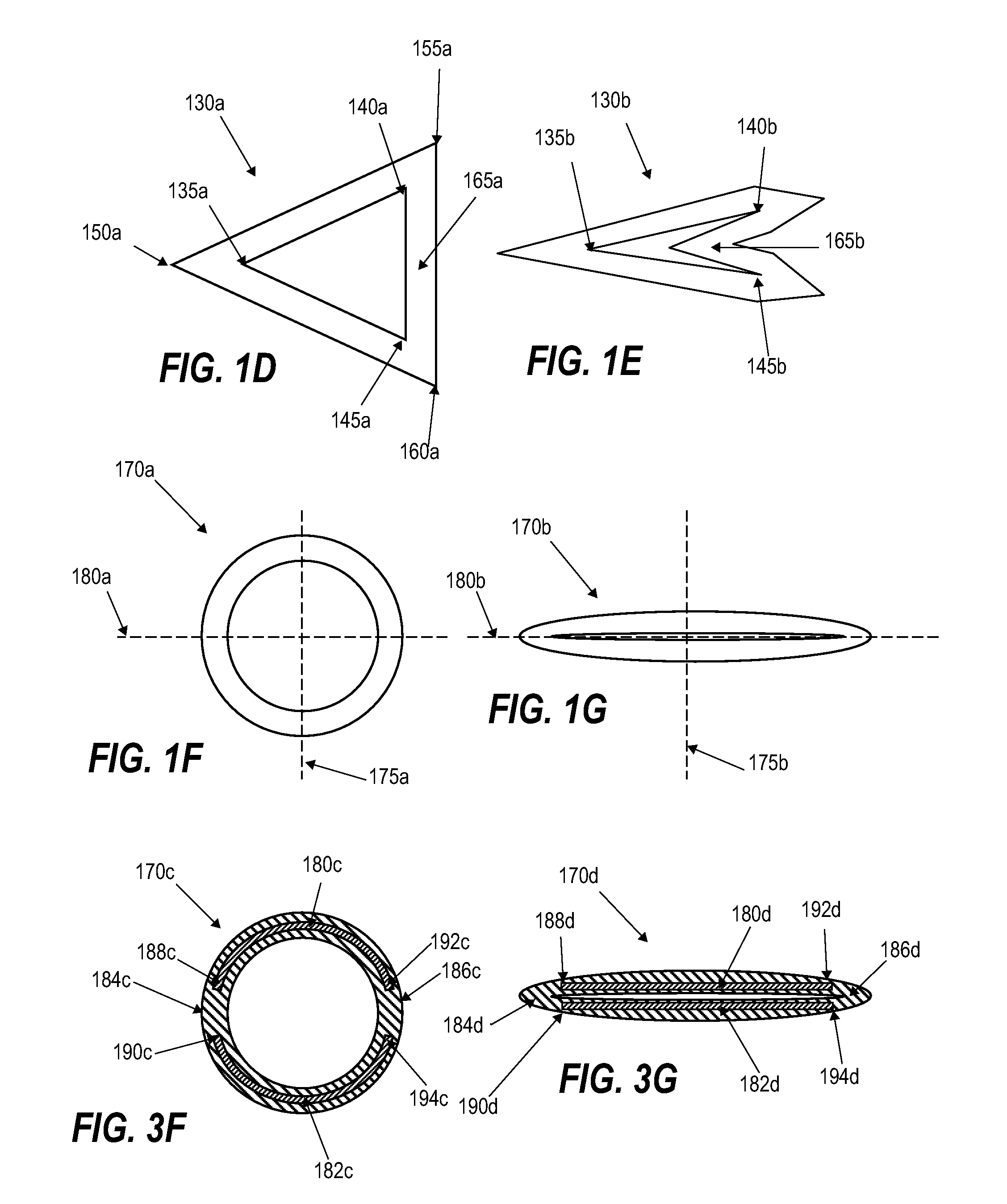 Devices and methods for push-delivery of implants