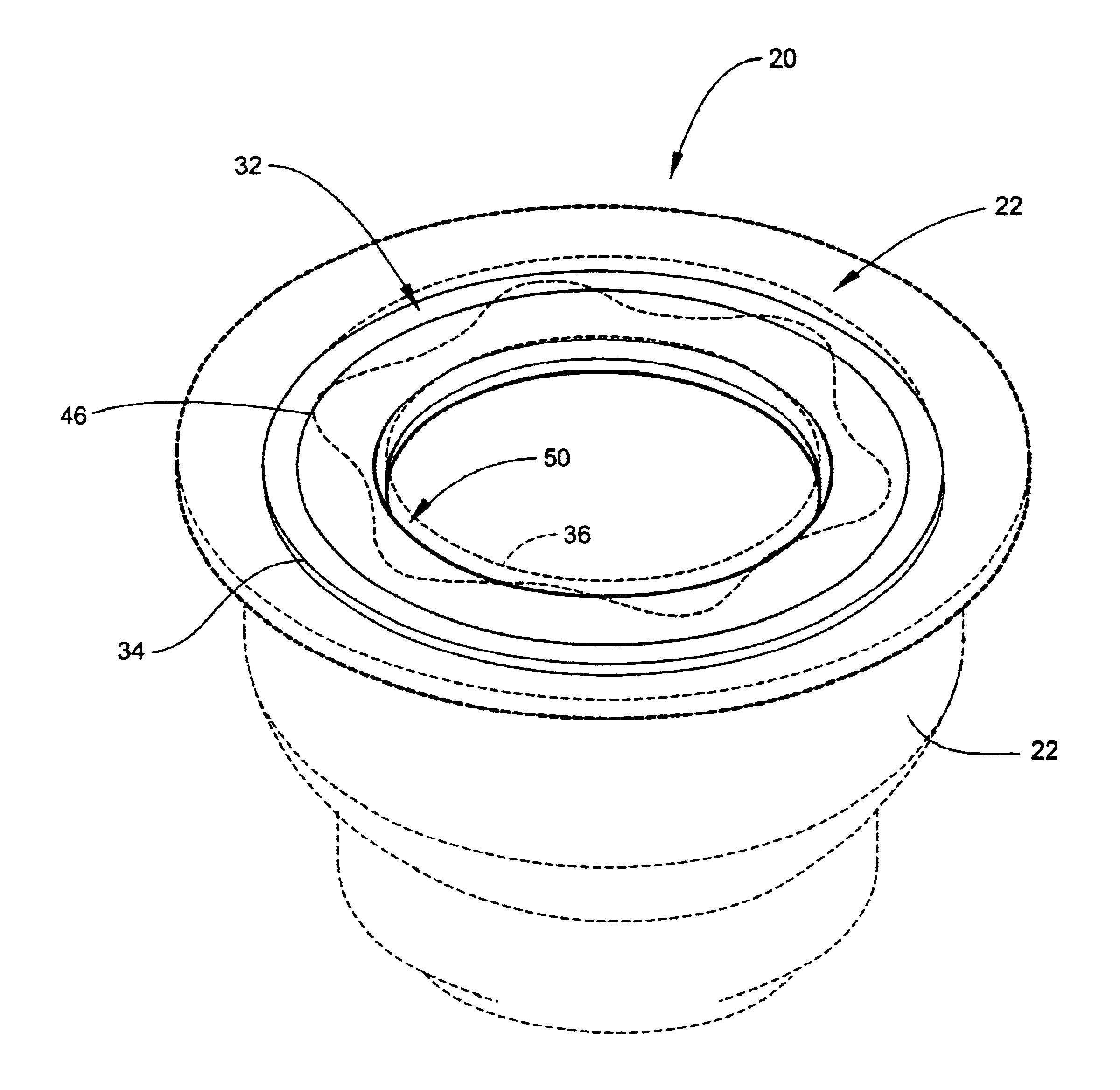 Tangential stress reduction system in a loudspeaker suspension