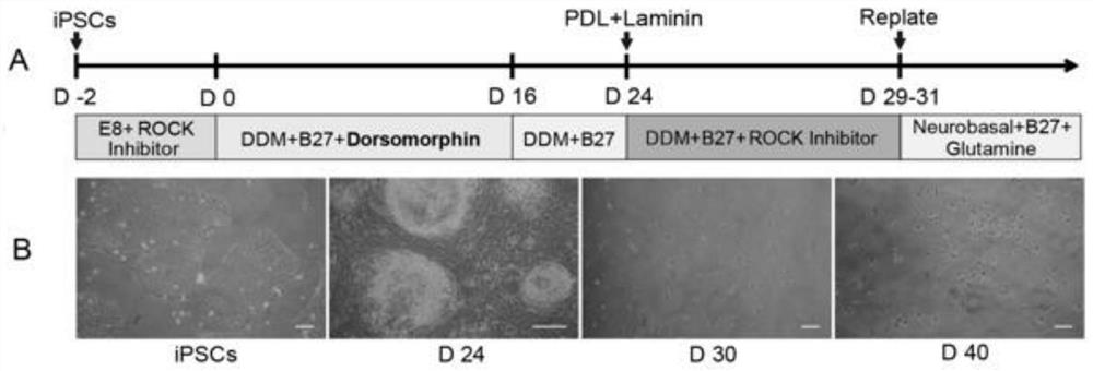 Human iPSC-sourced pyramidal nerve cell precursor cell as well as preparation method and application thereof