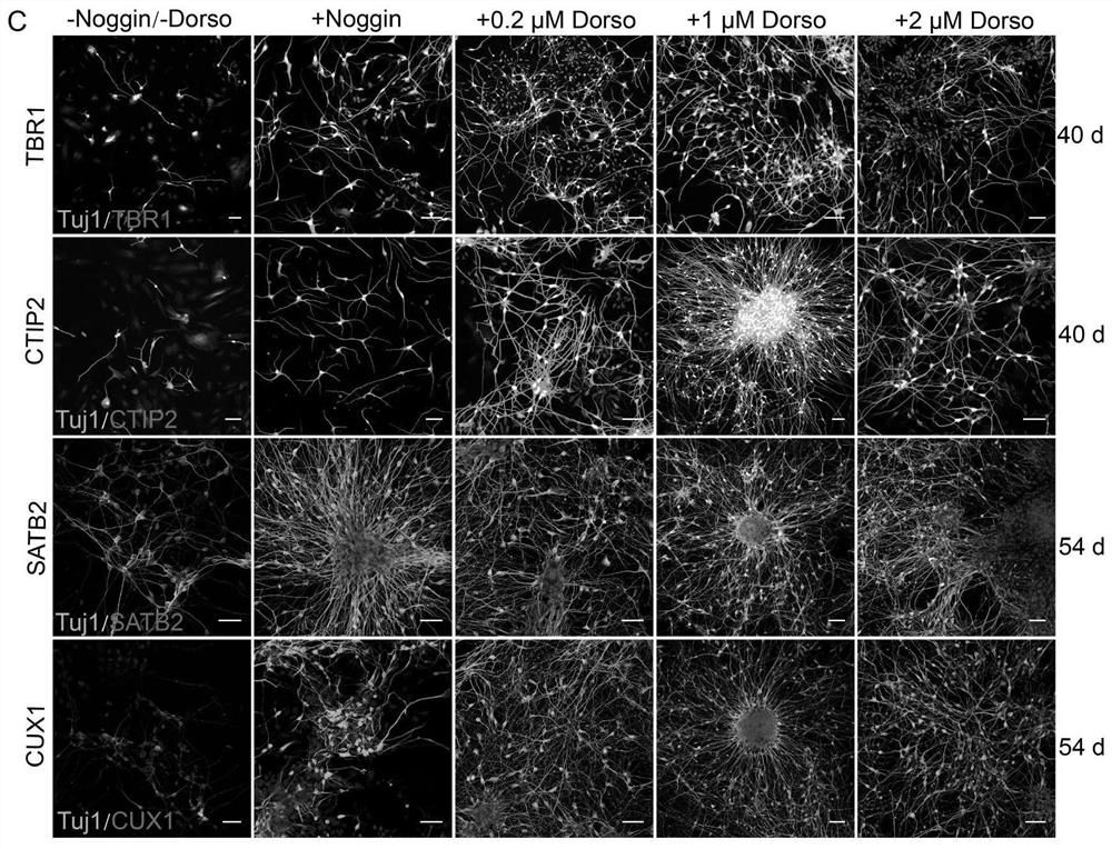 Human iPSC-sourced pyramidal nerve cell precursor cell as well as preparation method and application thereof