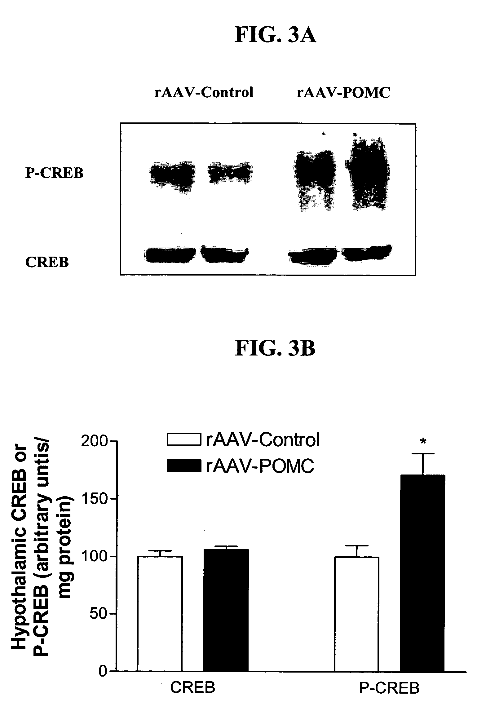 RAAV vector-based pro-opiomelanocortin compositions and methods of use