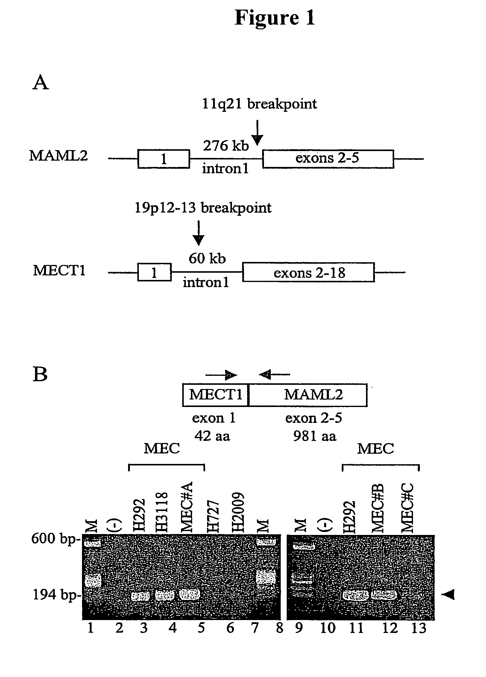Detection of MECT1-MAML2 fusion products
