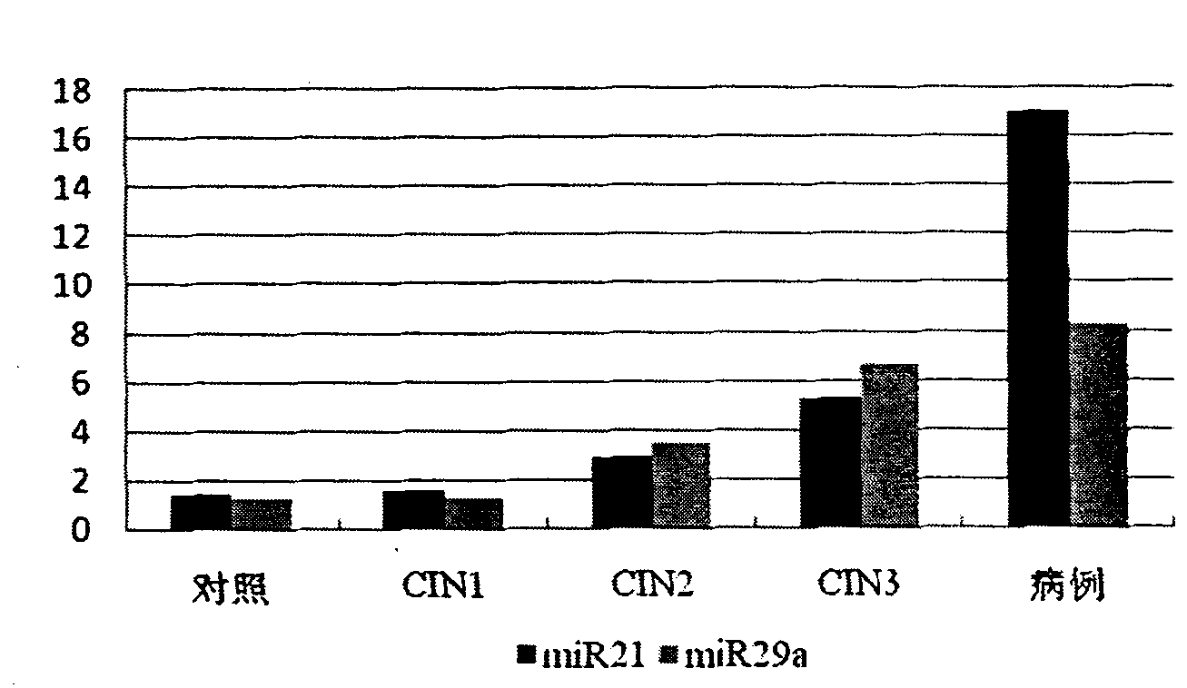 Serum/plasma miRNA serum marker related to cervical carcinoma and precancerous lesions thereof and application thereof