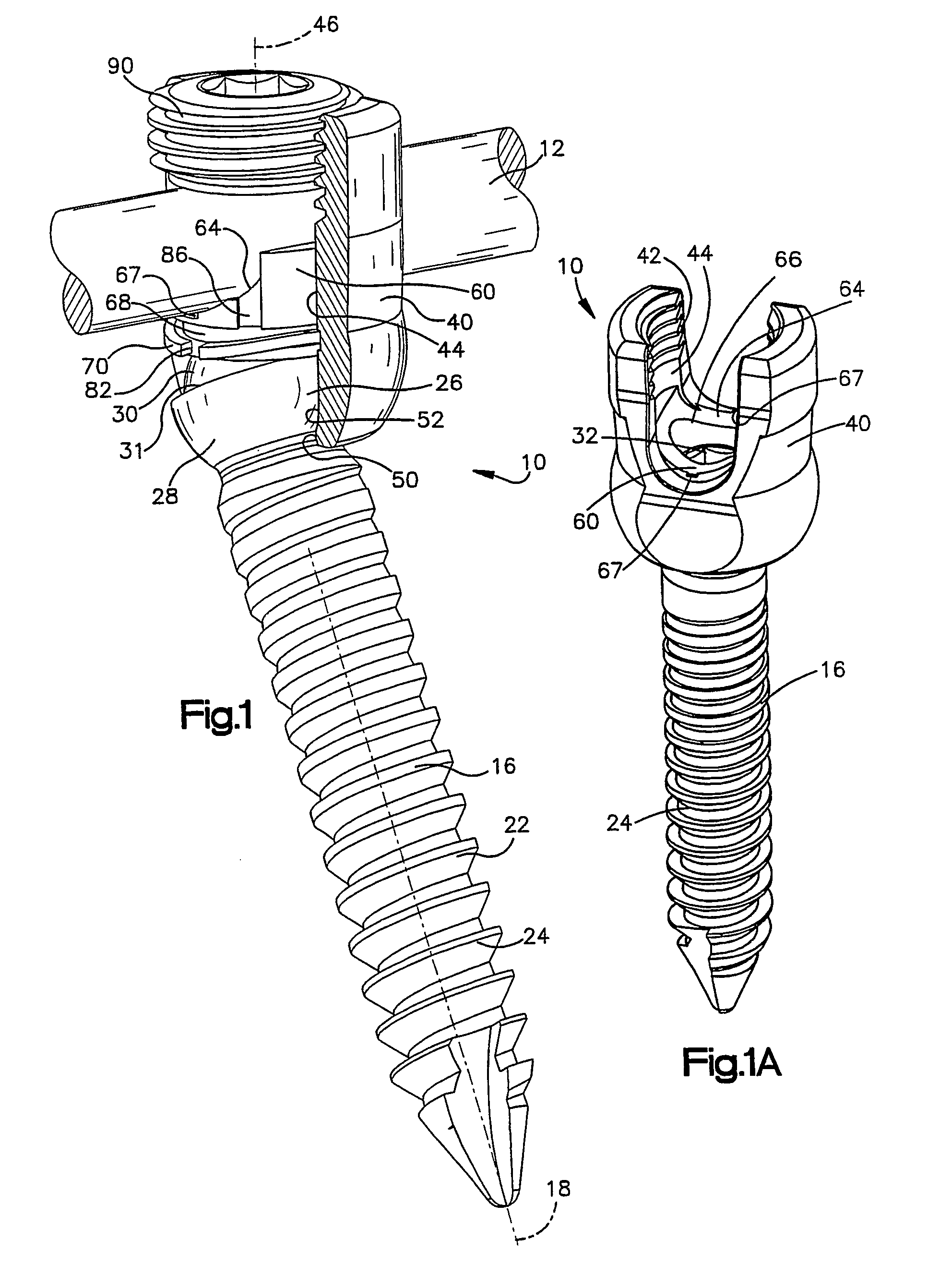 Apparatus for connecting a longitudinal member to a bone portion