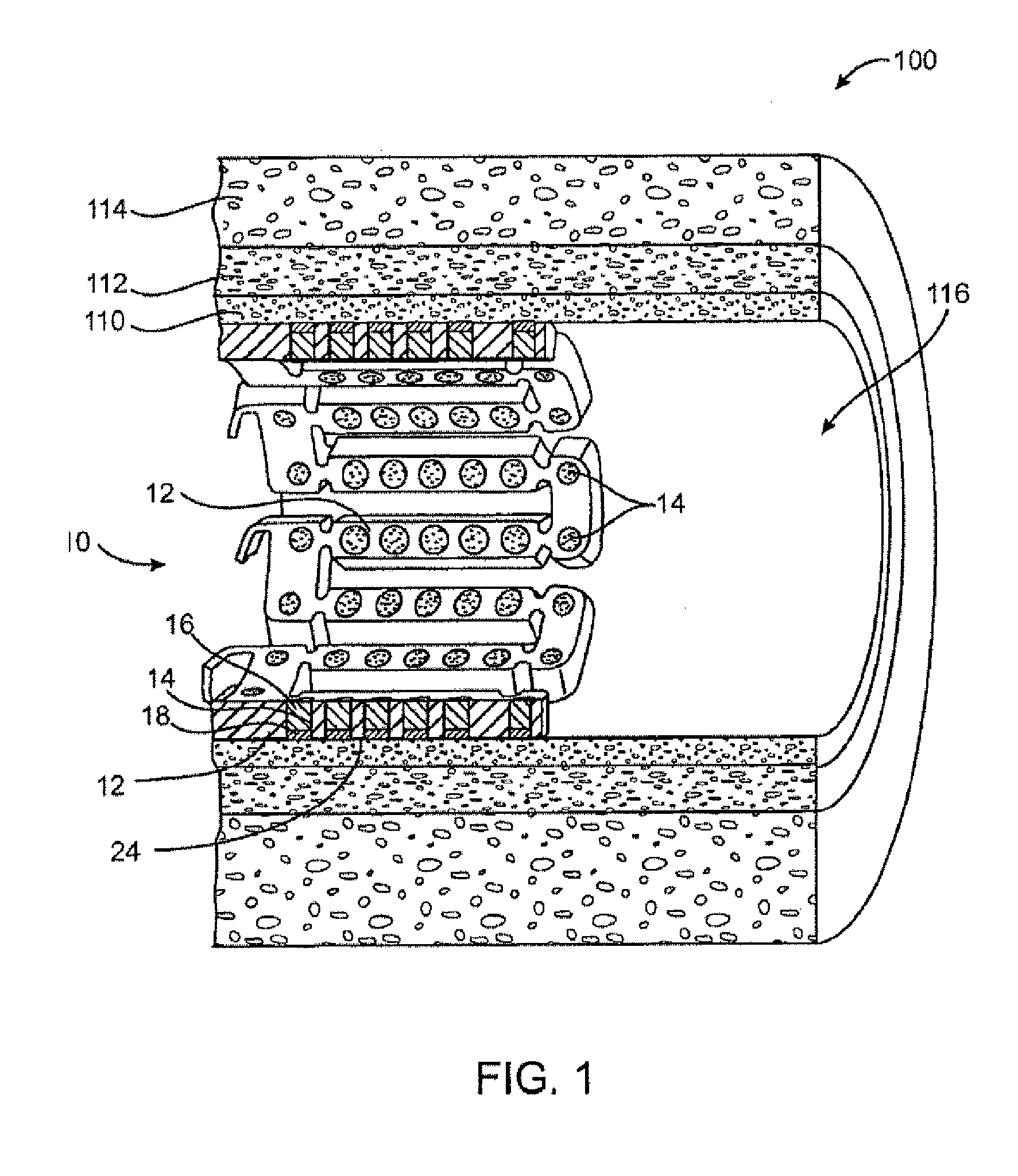 Methods and Devices for Reducing Tissue Damage After Ischemic Injury